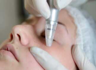 Mikrodermabrazja Zabiegi dermabrazji Gdańsk