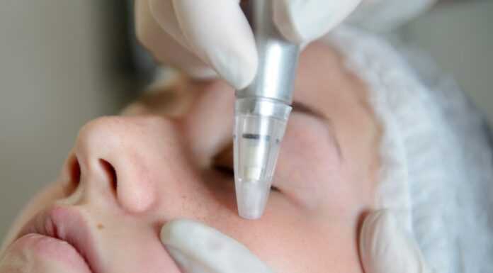 Mikrodermabrazja Zabiegi dermabrazji Gdańsk